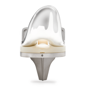 Personalized Orthopedic Solutions for Knee & Hip | ODEV